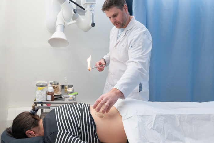Acupuncture