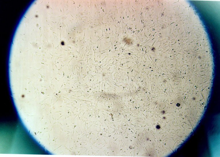 Cytogénétique clinique